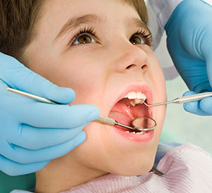 Dental Care For Children