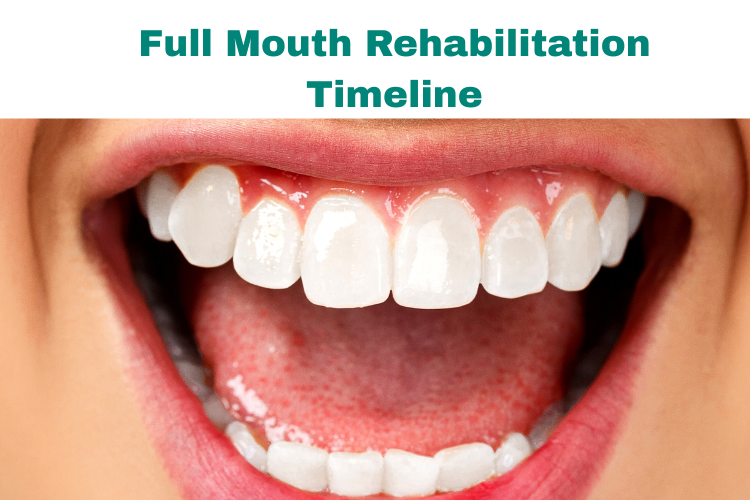 Full Mouth Rehabilitation Timeline