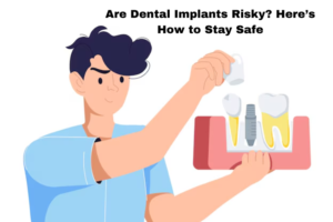 Are Dental Implants Risky? Here’s How to Stay Safe