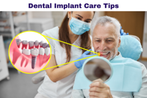 dental implant care tips