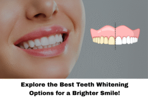best teeth whitening options