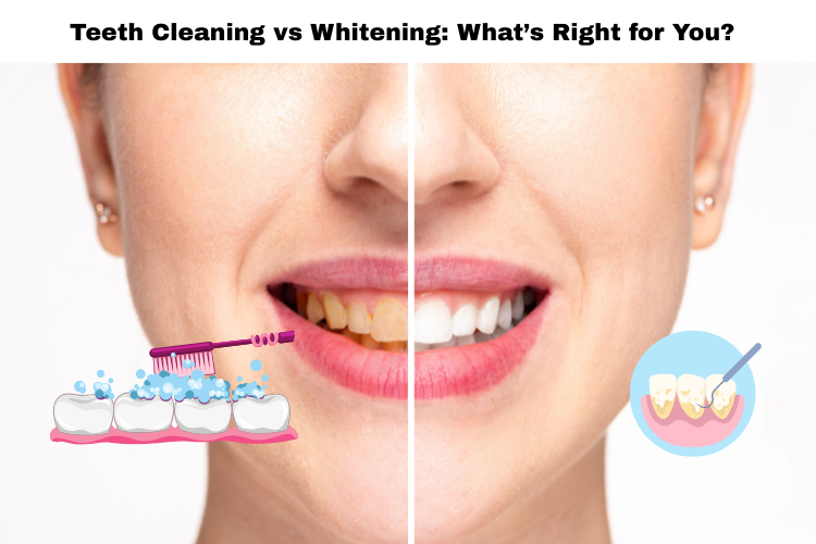 teeth cleaning vs teeth whitening