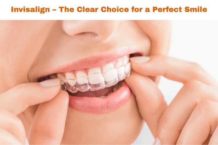 benefits of invisalign
