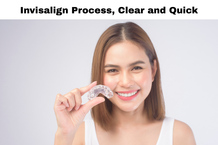 invisalign treatment
