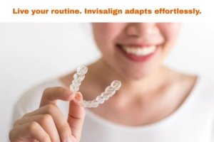 invisalign daily routine