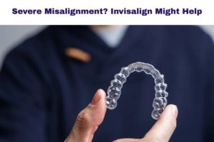 invisalign for severe cases