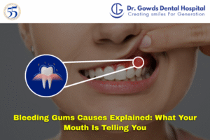 bleeding gums causes
