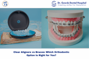 Side-by-side comparison of aligners vs braces