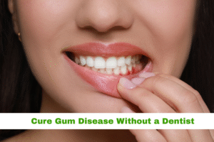 gum disease