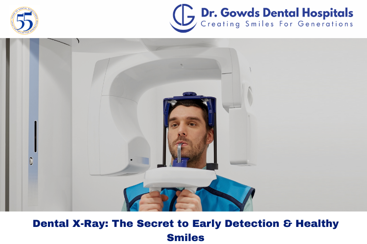 dental x-ray