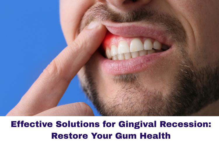 effective solutions for gingival recession