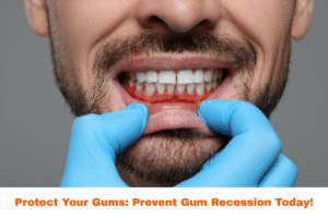 Healthy gums with no signs of recession | Prevent gum recession