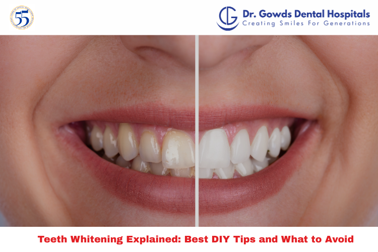 Close-up of a smile after DIY teeth whitening treatment