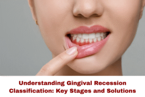 gingival recession classification