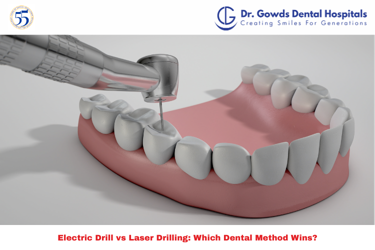 Electric Drill vs Laser Drilling – Pros & Cons