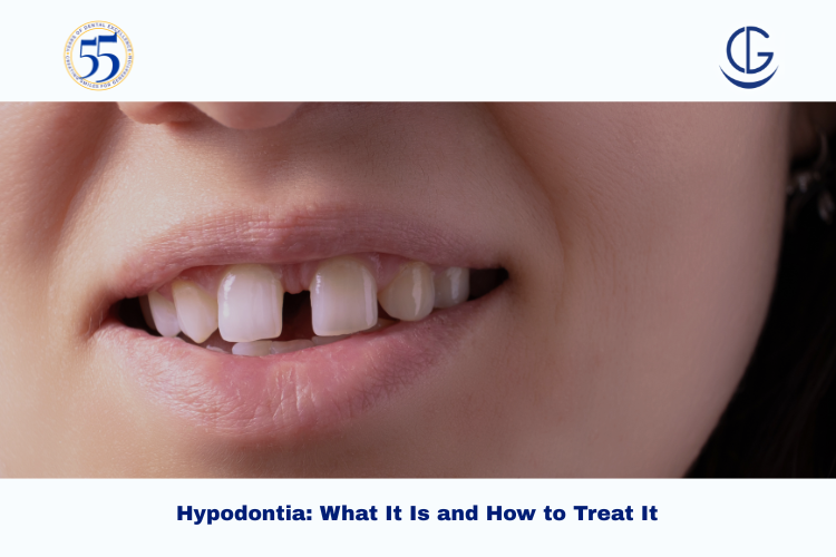 hypodontia