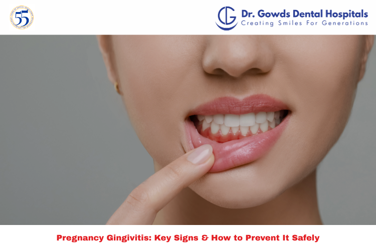 Pregnancy Gingivitis