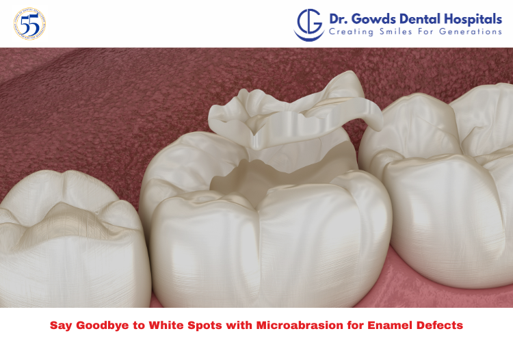 Dental microabrasion for enamel defects