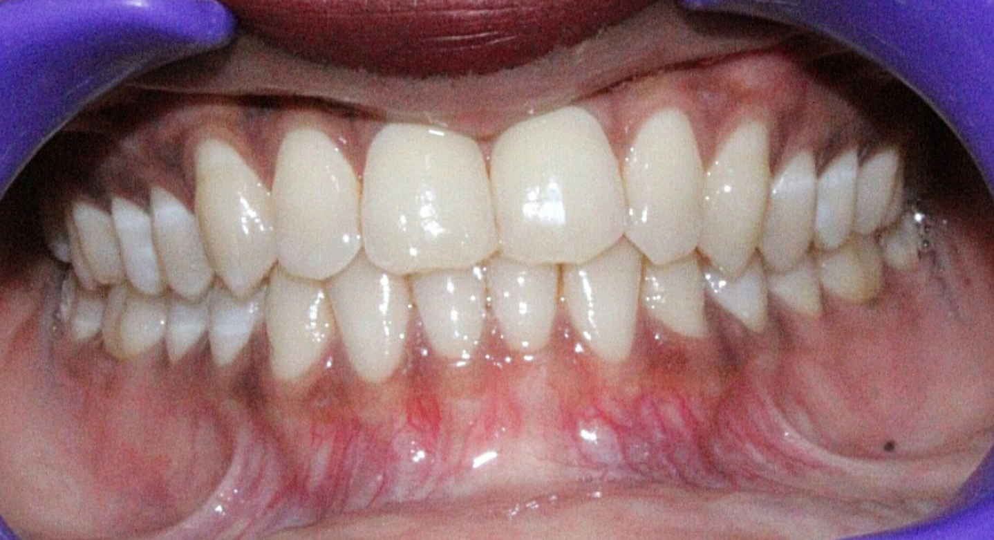 Before image