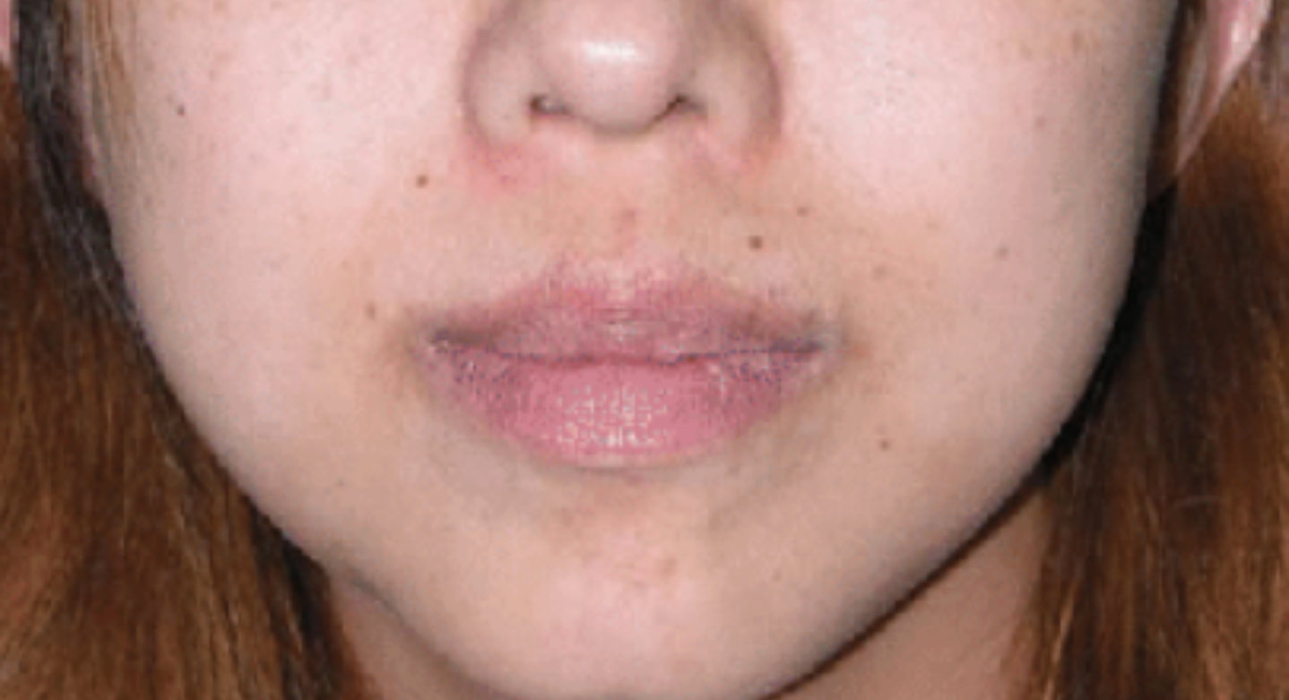 Before image