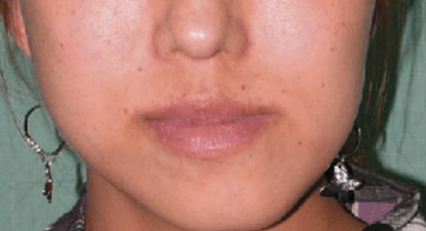 After image