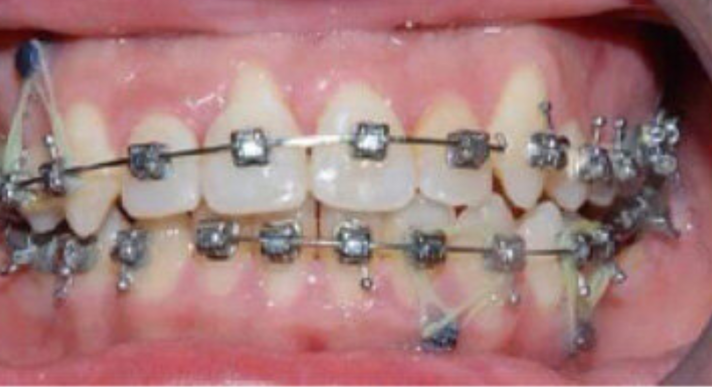 Before image