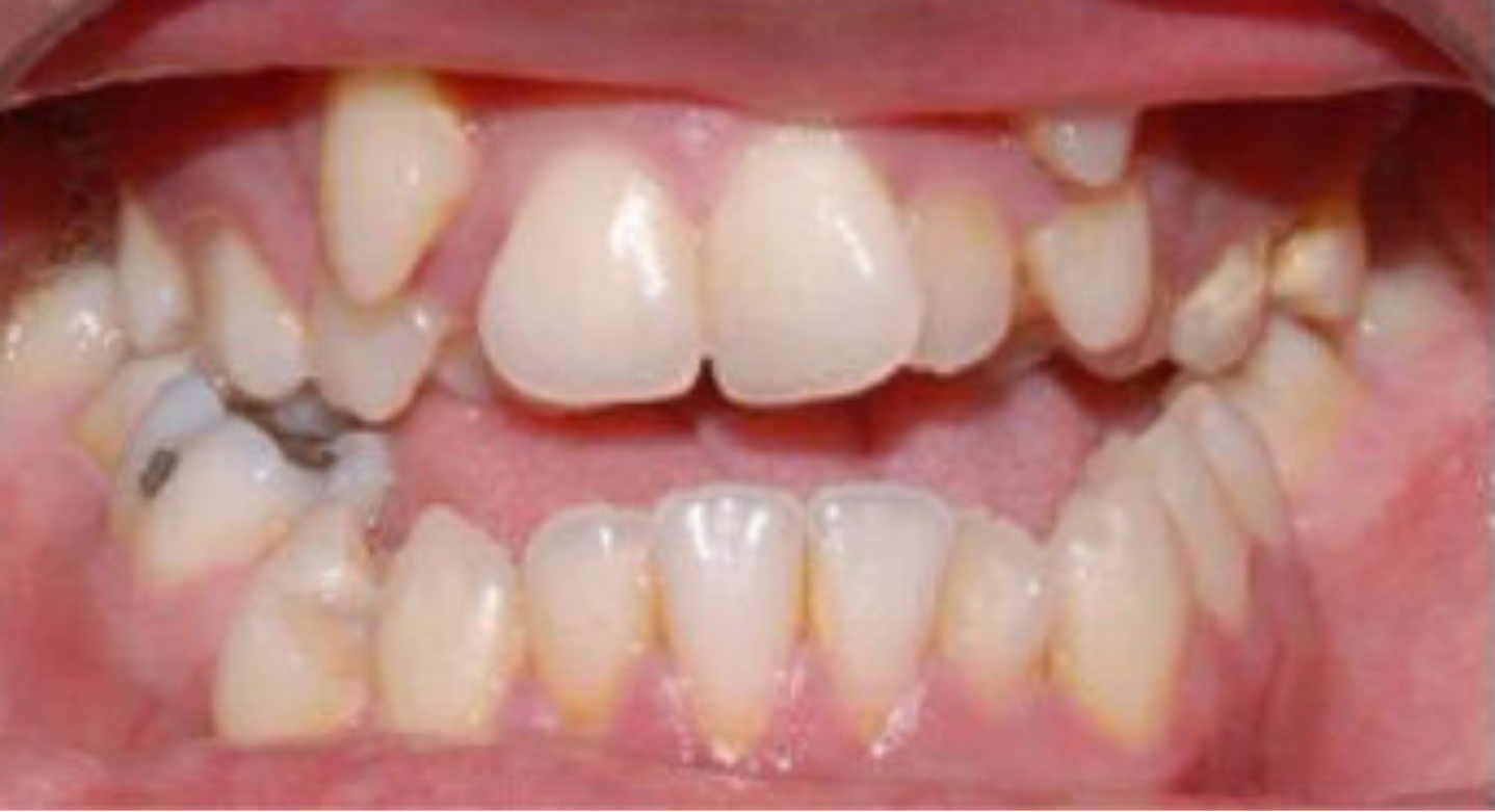 After image