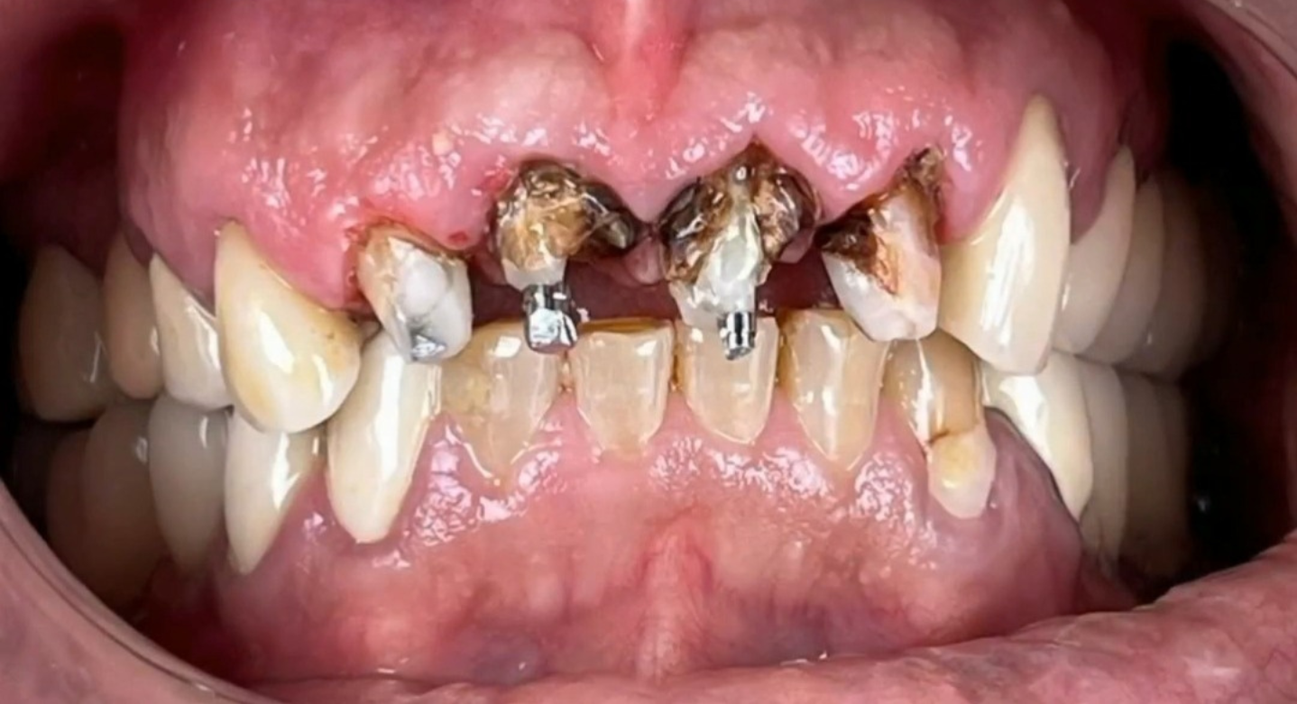 After image