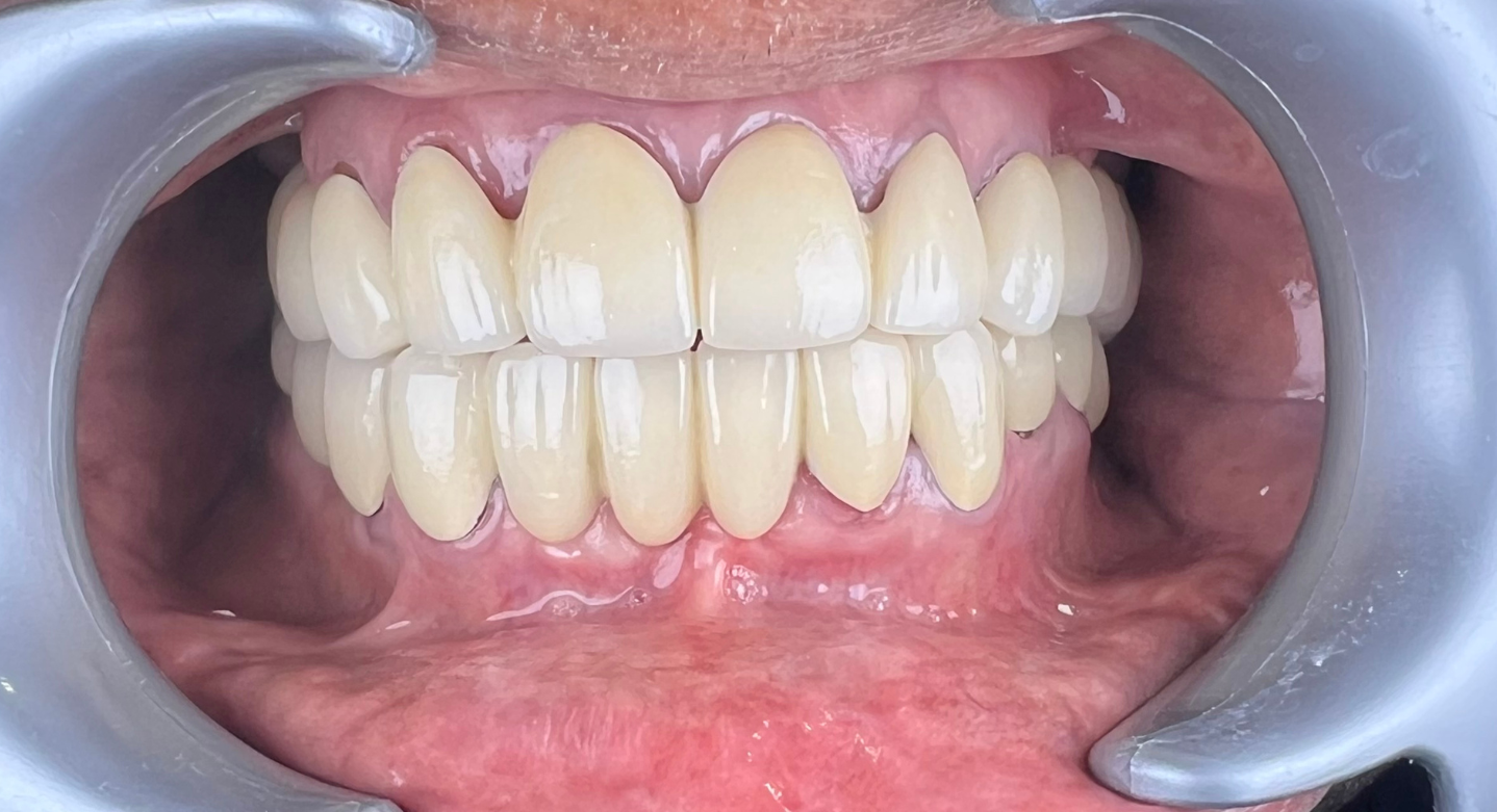 Before image