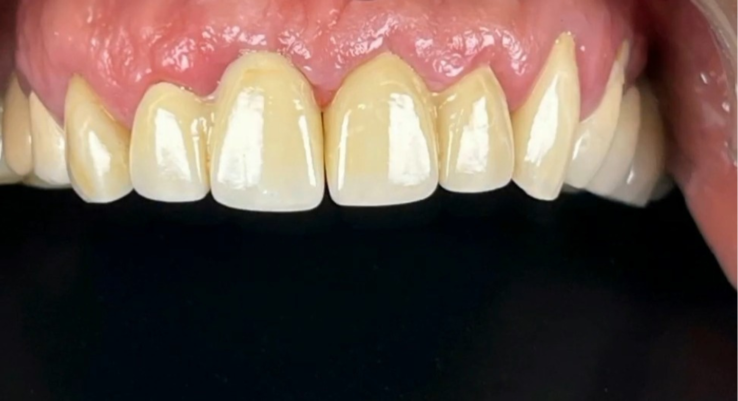 Before image