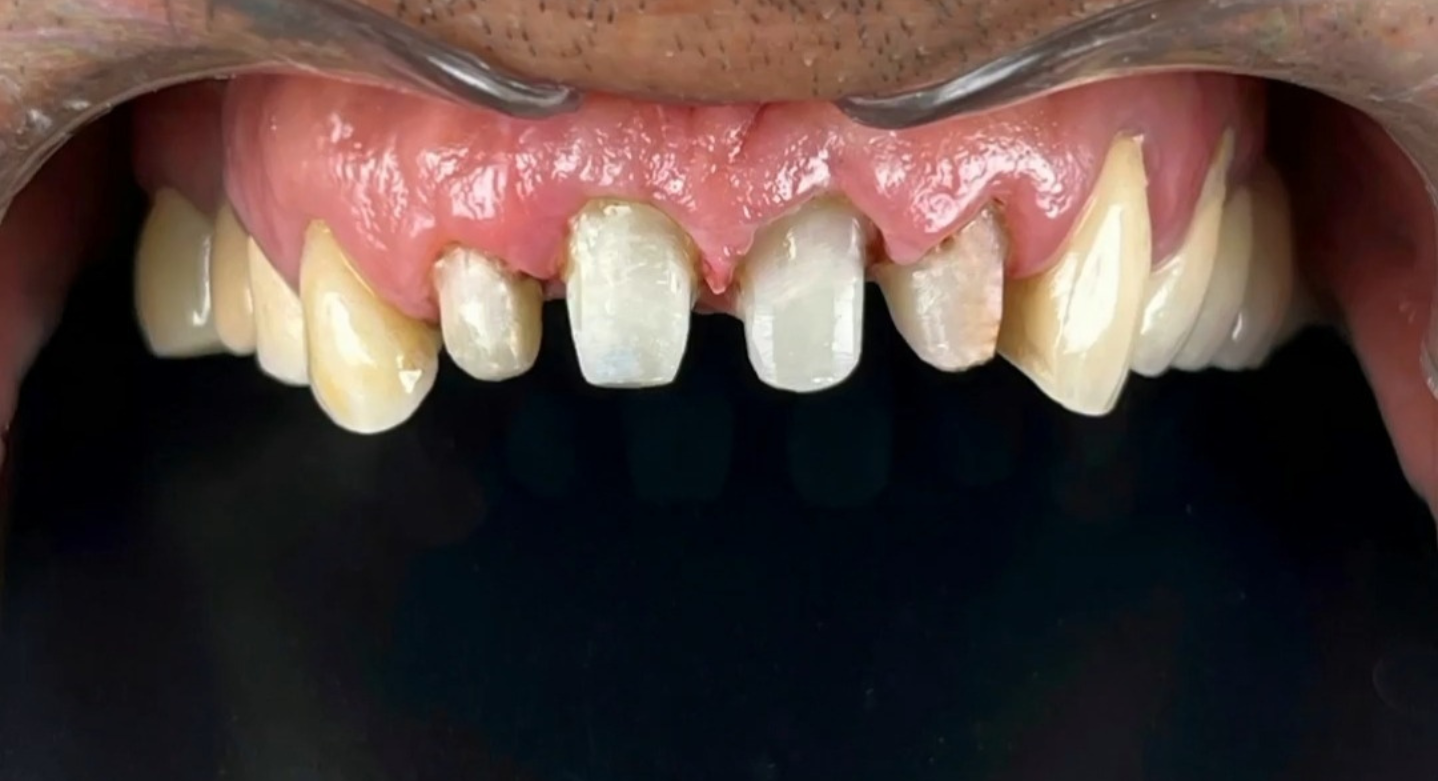 After image