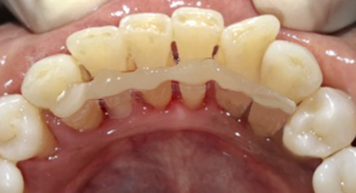 Before image