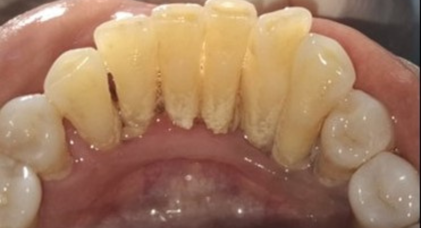 After image