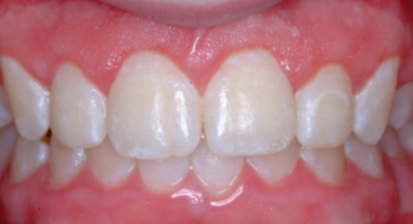 Before image