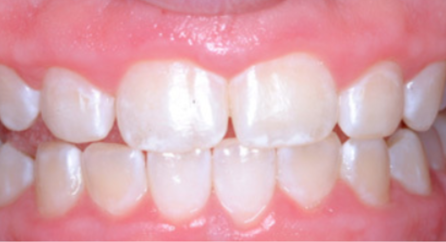 After image