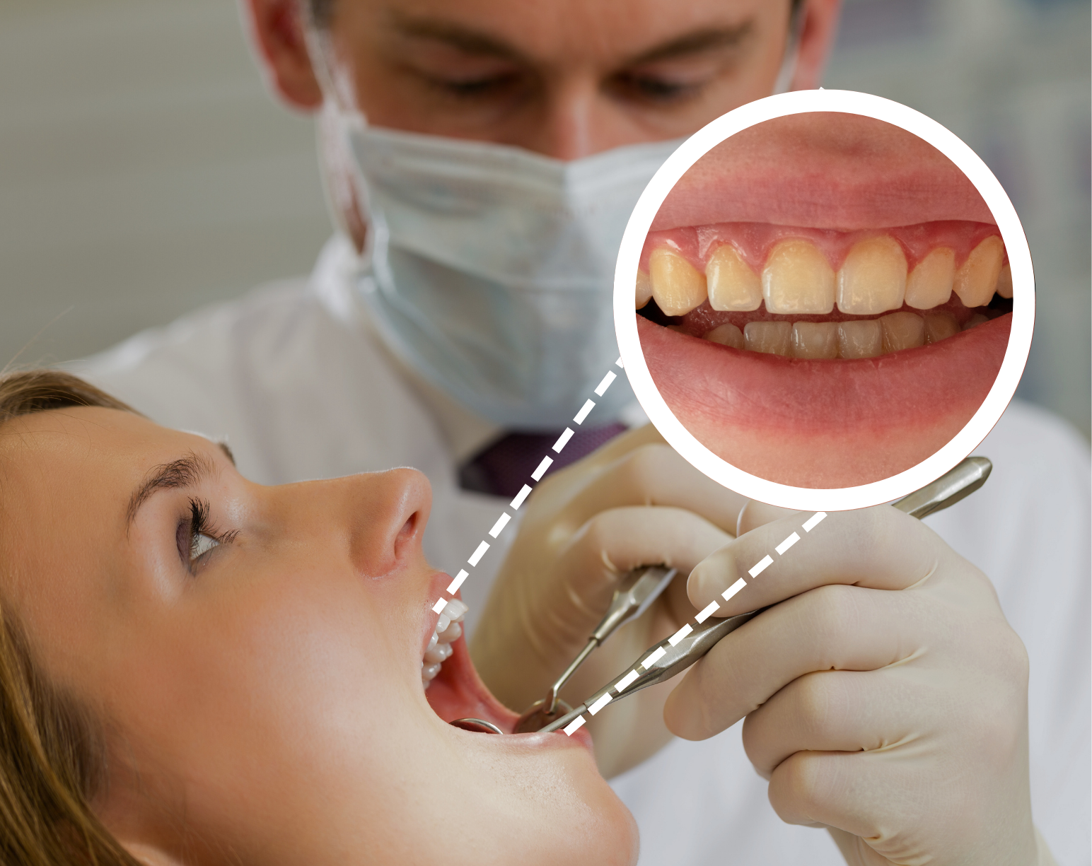 Our dentist is examining a patient’s teeth, with a close-up highlighting stained vs. whitened teeth.