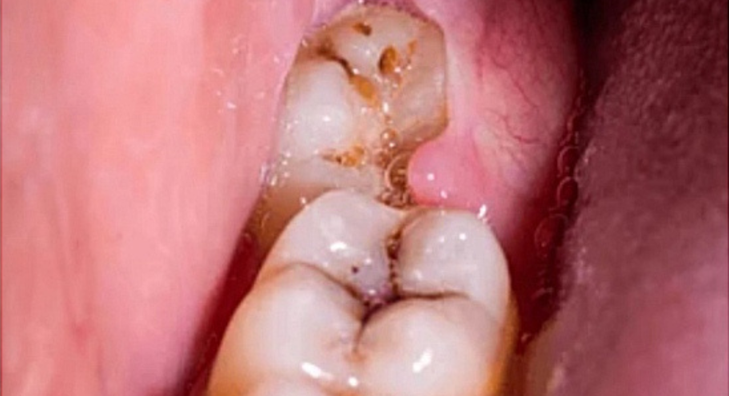 After image
