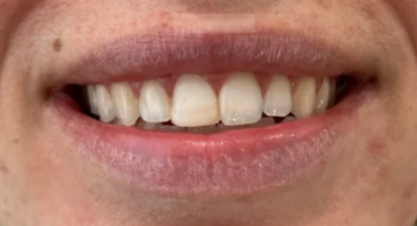 After image