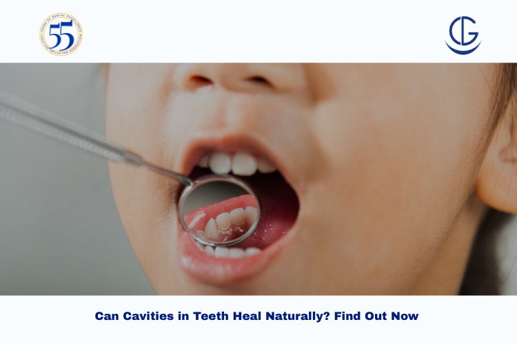 cavities in teeth