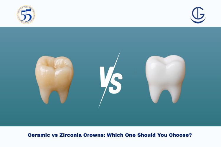 Ceramic vs Zirconia Crowns