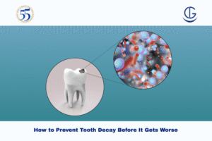 Tooth Decay