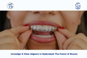 Invisalign and Clear Aligners in Hyderabad