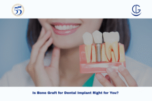 bone graft for dental implant