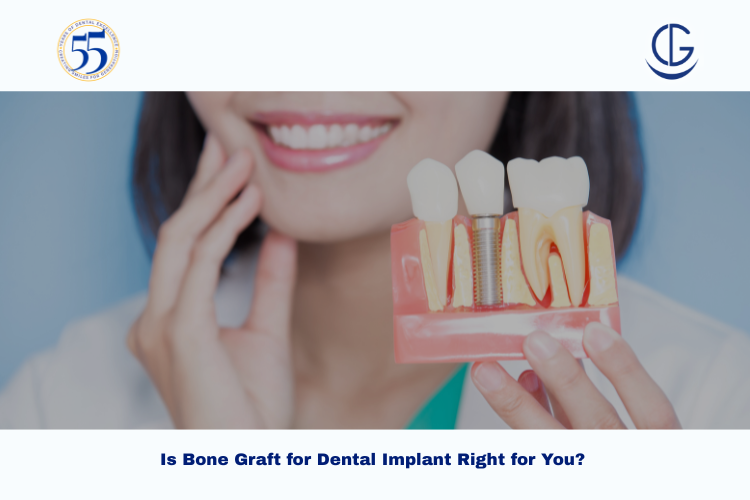 bone graft for dental implant