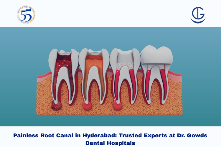 painless root canal