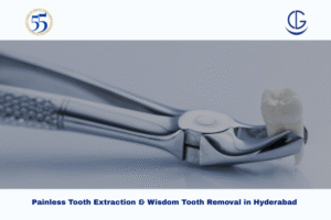 tooth extraction