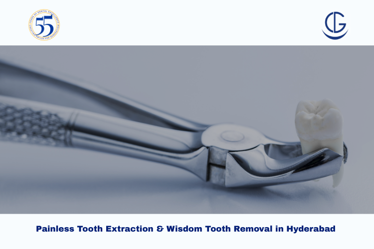 tooth extraction