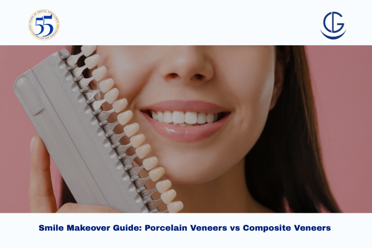 Porcelain Veneers vs Composite Veneers