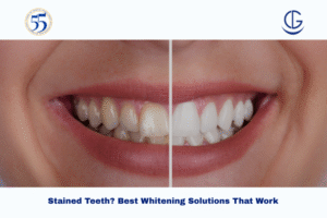 stained teeth