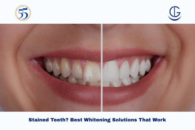 stained teeth